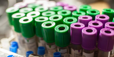 Здолбунівчанина перевіряють на коронавірус у львівській лікарні
